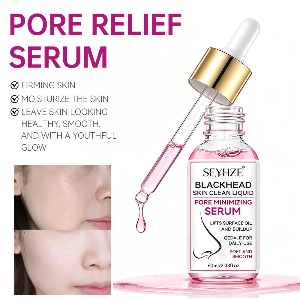 Pore Minimizing Serum