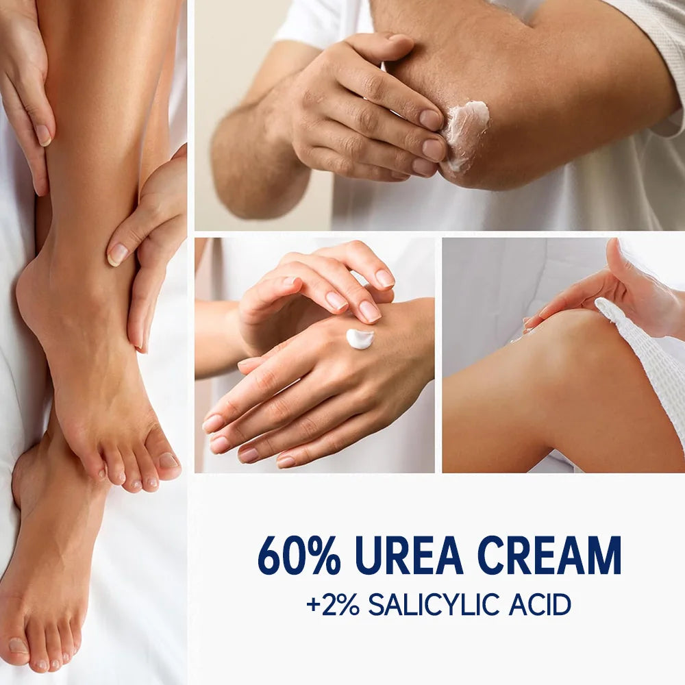 60% Urea Cream