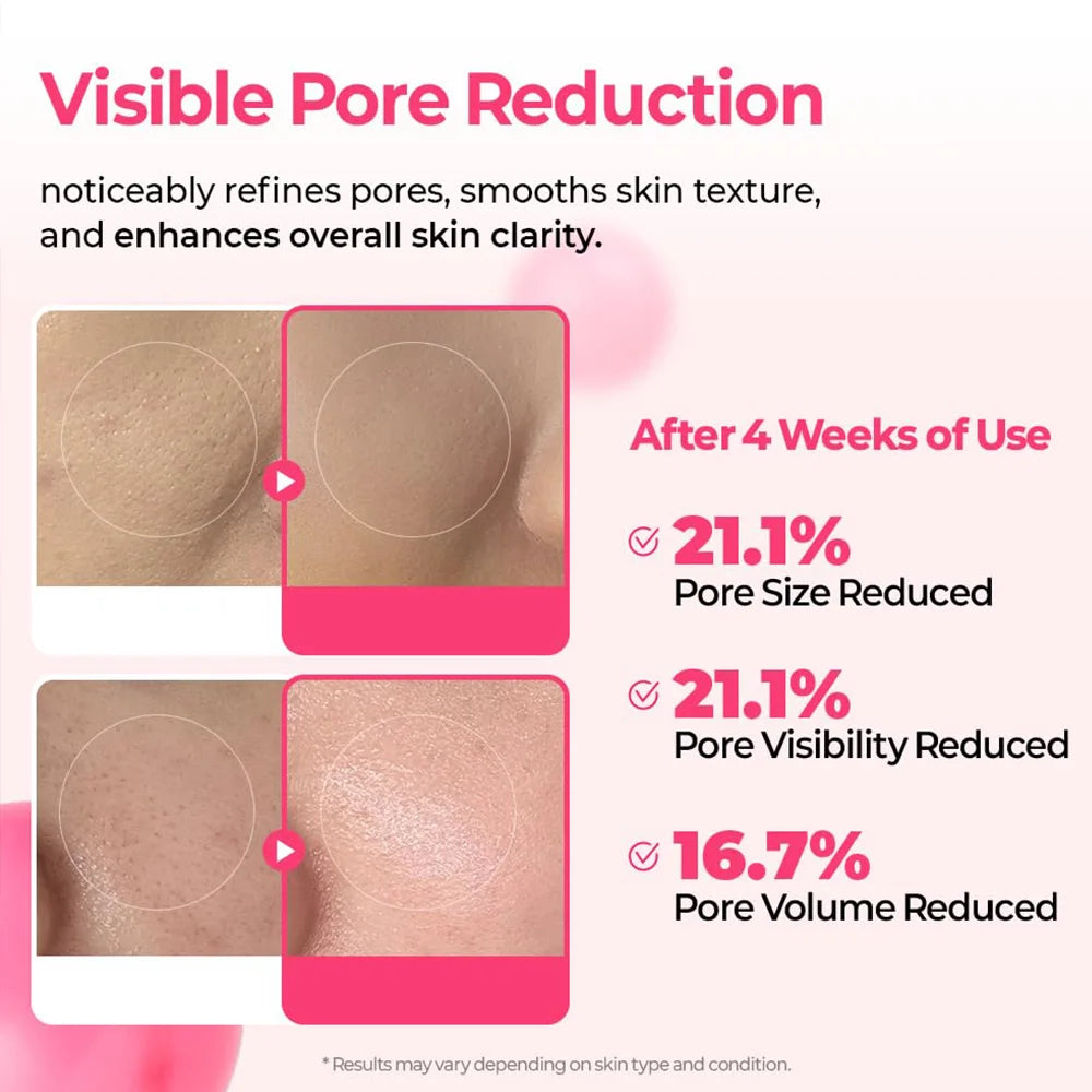 Pore Minimizing Serum
